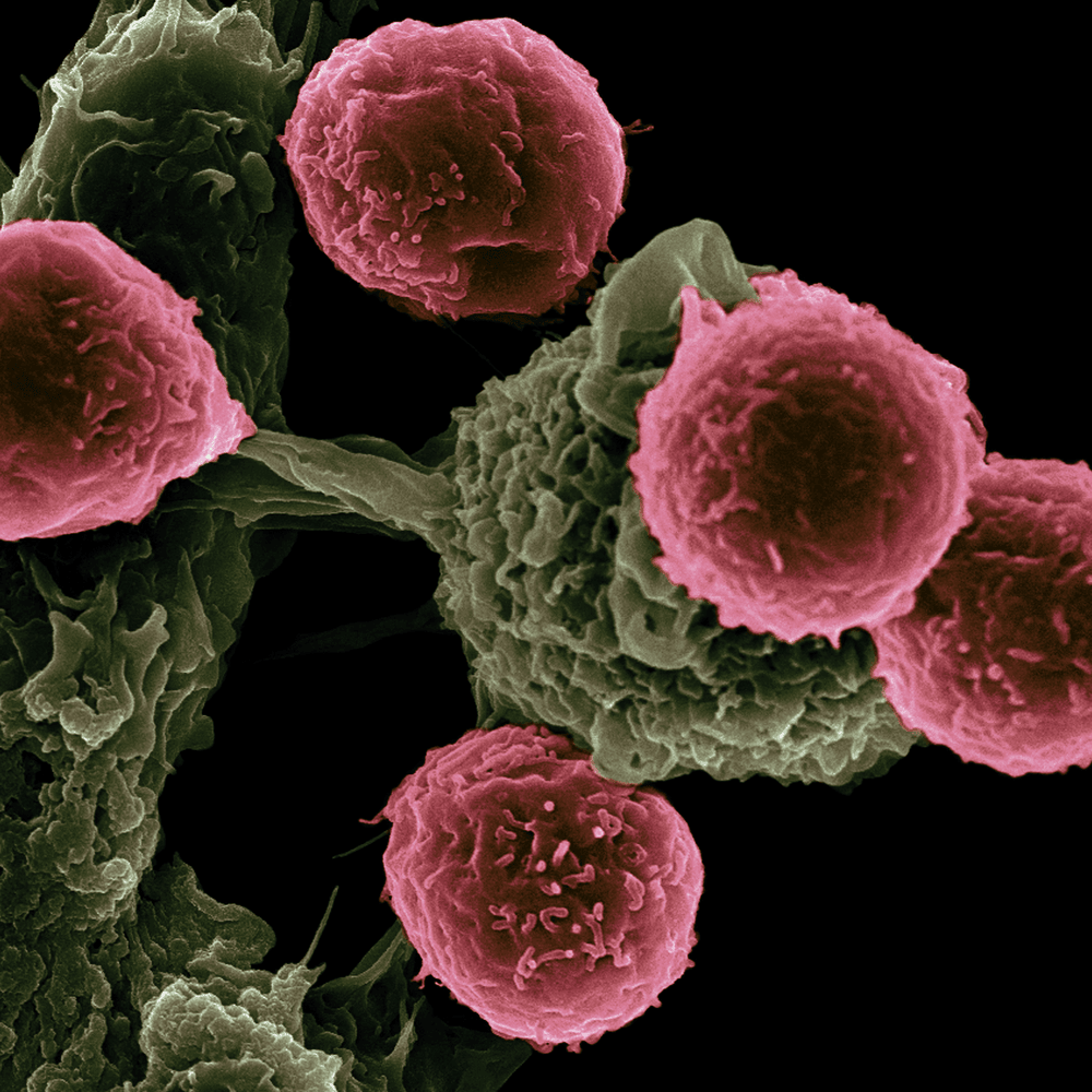 Breast Cancer Analysis App